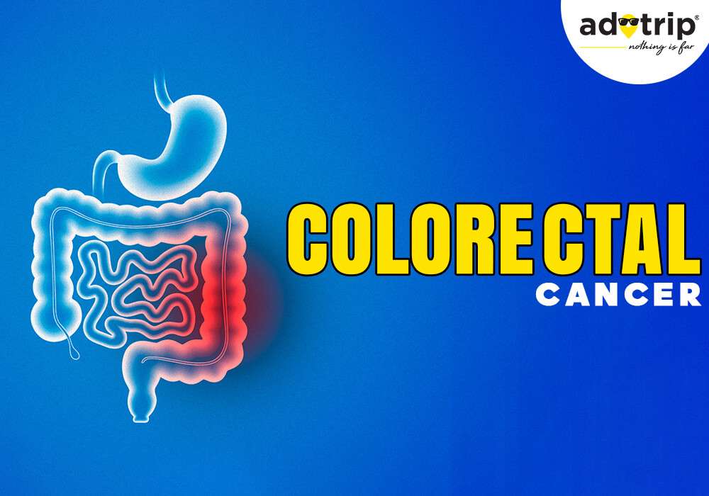 Colorectal cancer